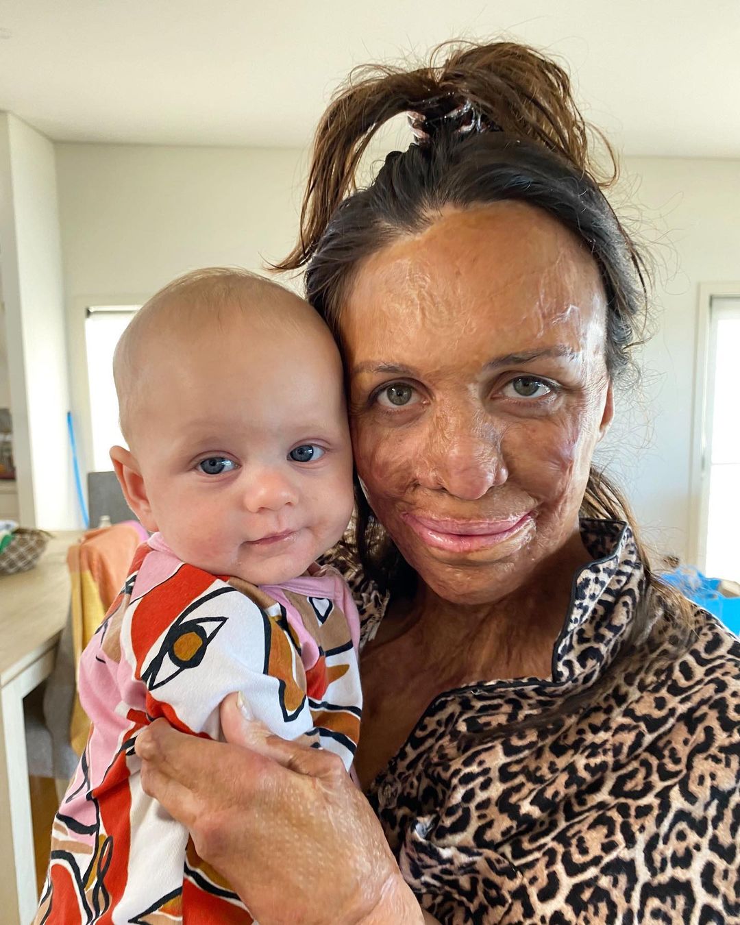 Turia Pitt