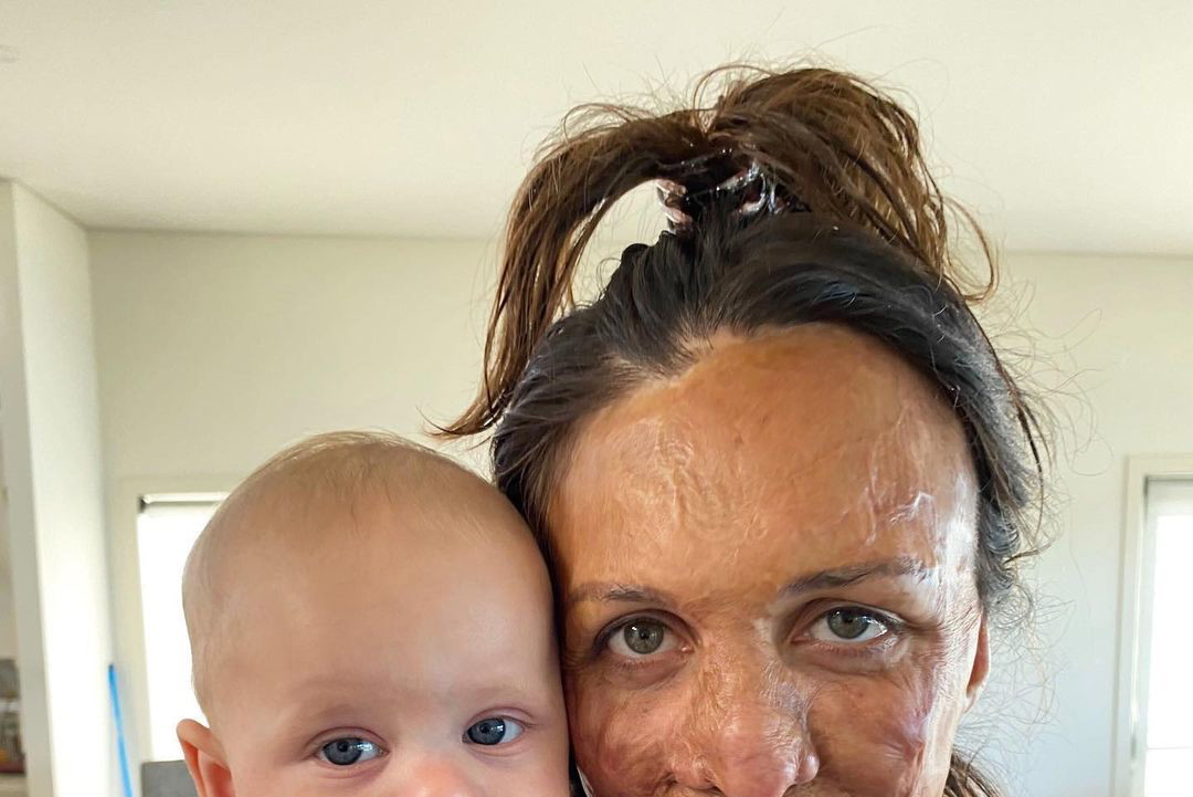 Turia Pitt