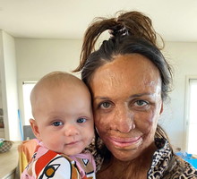 Turia Pitt