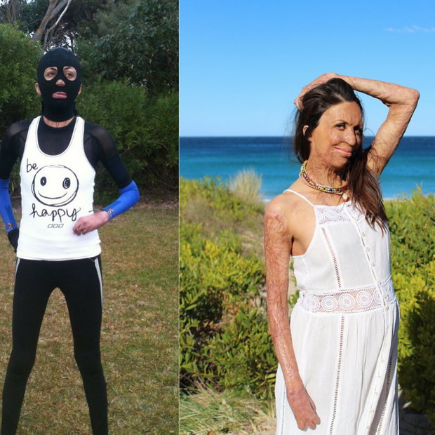 Turia Pitt