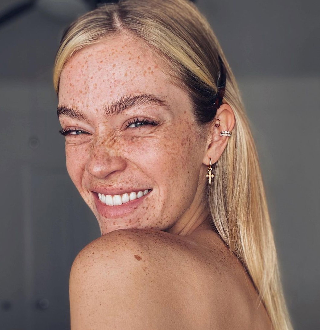 Kosmetyki rozjaśniające przebarwienia