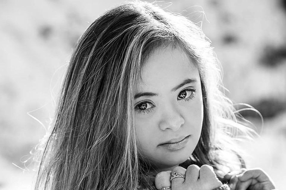 Kennedy Garcia: nastolatka z Zespołem Downa podbija świat mody