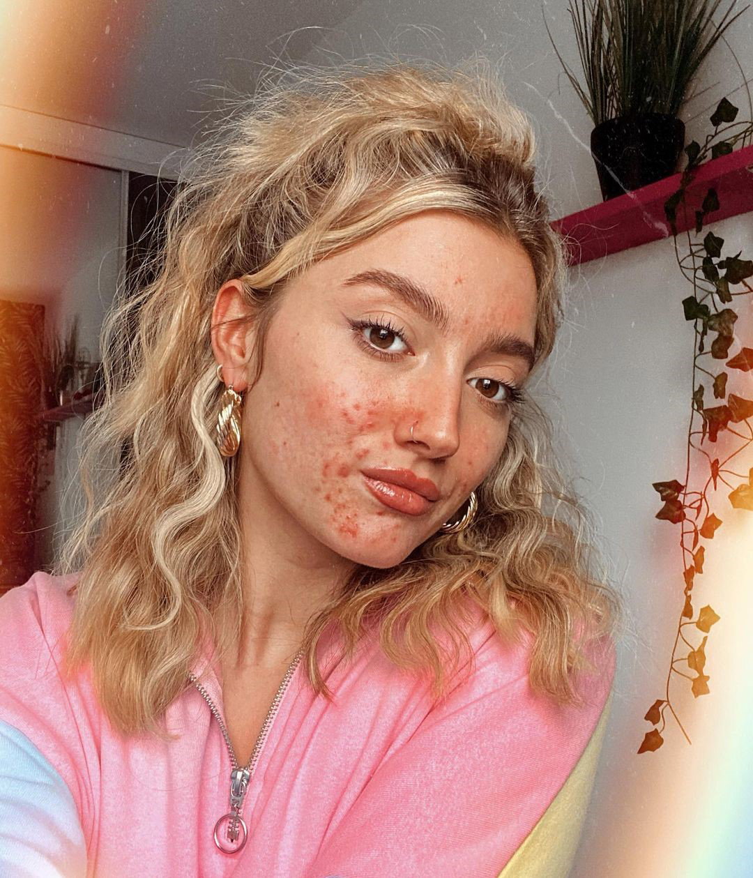 Izzie Rodger, modelka z trądzikiem w reklamie znanej marki. "Gdzie były takie modelki, kiedy dorastałam"?