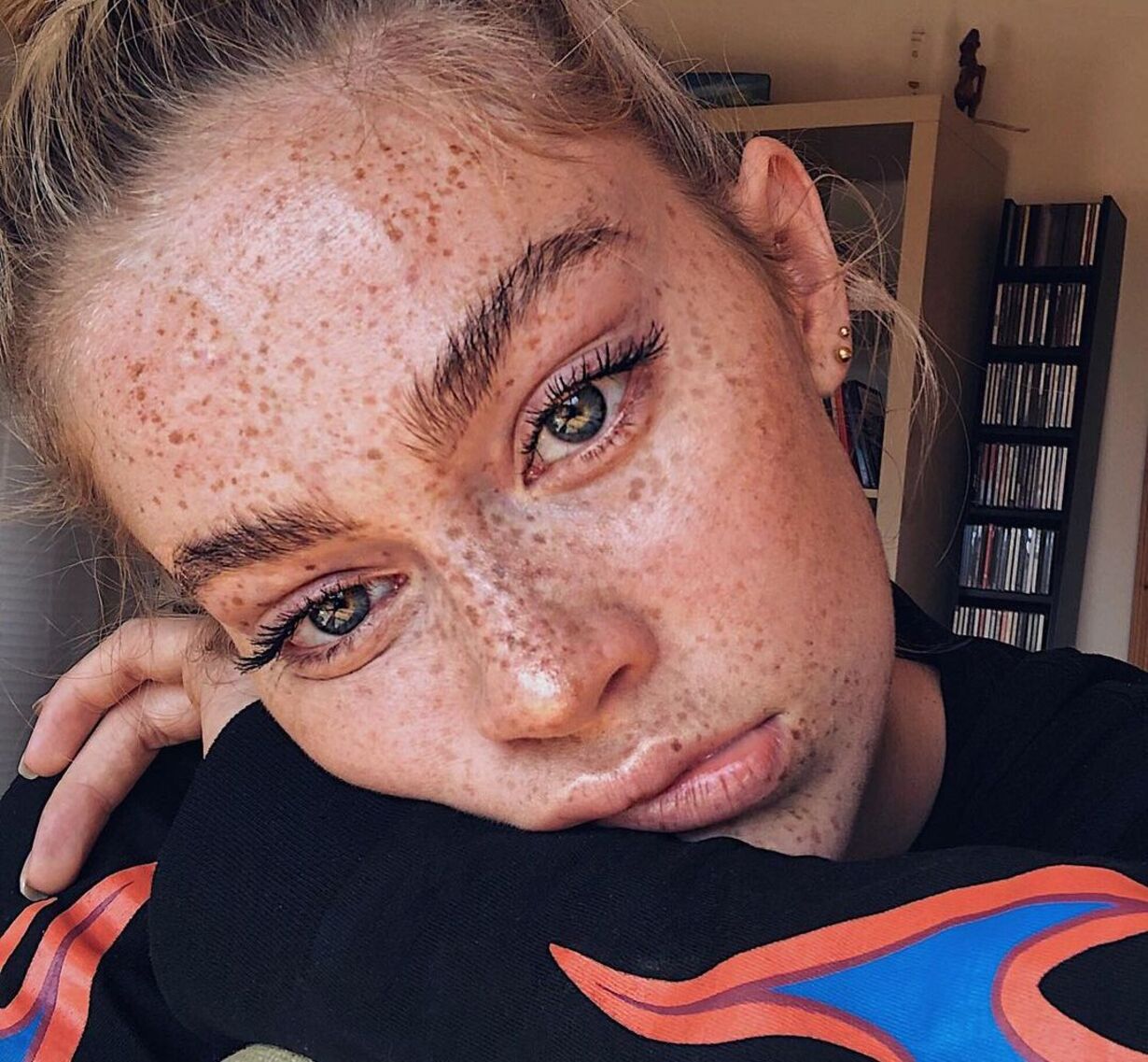 Co na przebarwienia na twarzy?