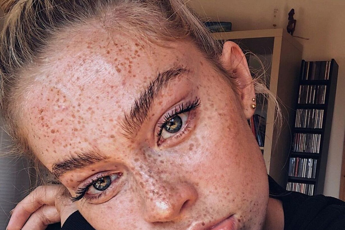 Co na przebarwienia na twarzy?