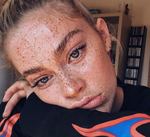 Co na przebarwienia na twarzy?