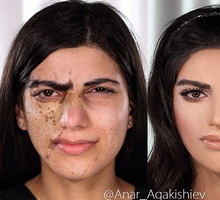 Anar Agakishiev maluje kobiety po wypadkach i poparzeniach