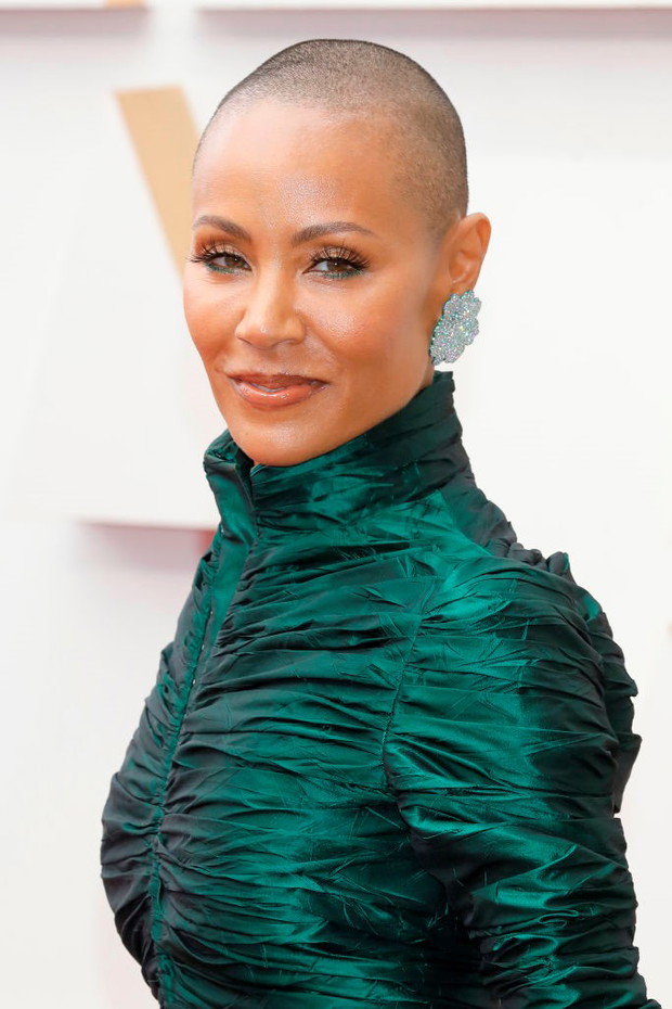 Jada Pinkett Smith choruje na łysienie plackowate