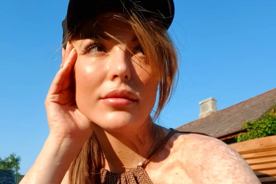 Katarzyna Dacyszyn pokazała zdjęcie z Instagrama