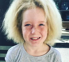 U tej dziewczynki rozpoznano "zespół włosów niedających się uczesać". Mało kto z nas słyszał o takim terminie. Wyjaśniamy, na czym to polega