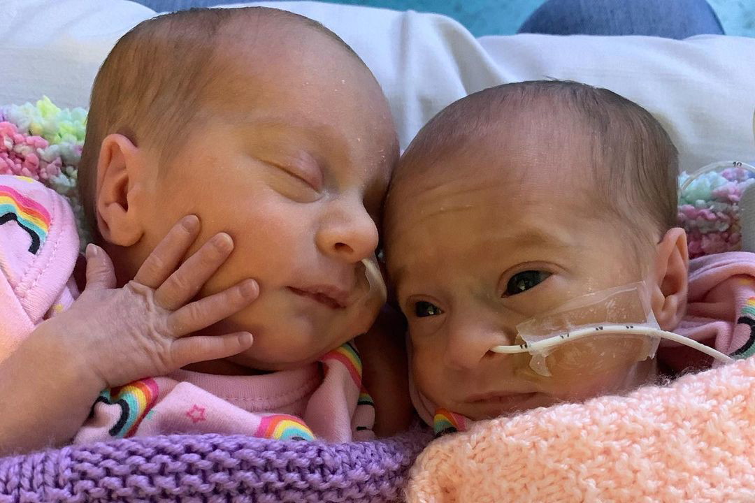 Bliźniaczki Aria i Skylar Morgan-Trodden