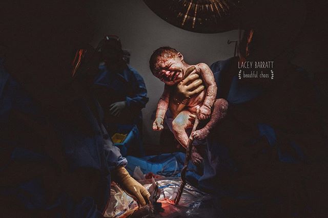 Porodowe zdjęcia autorstwa Lacey Barratt