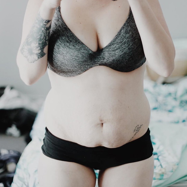 Brzuch po porodzie