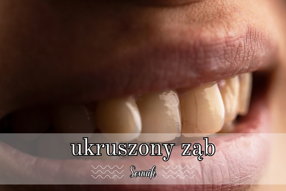 Sennik ukruszony ząb u siebie