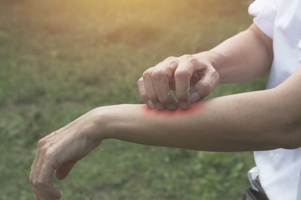 Meszki - jak się ich pozbyć