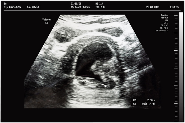 An ultrasound of a mother fetus during the 08th week background as Medical and Health of the baby concept. vector illustration.