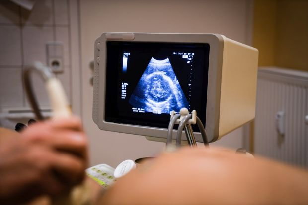 Jakie są przyczyny zespołu taśm owodniowych?