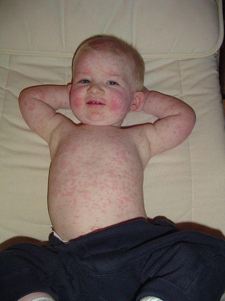 imgSwqGW7-06ac077