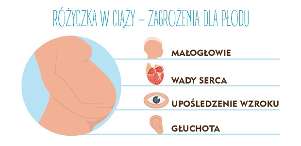 Różyczka w ciąży
