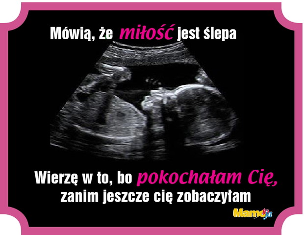 imgtuOzcl-abd6747