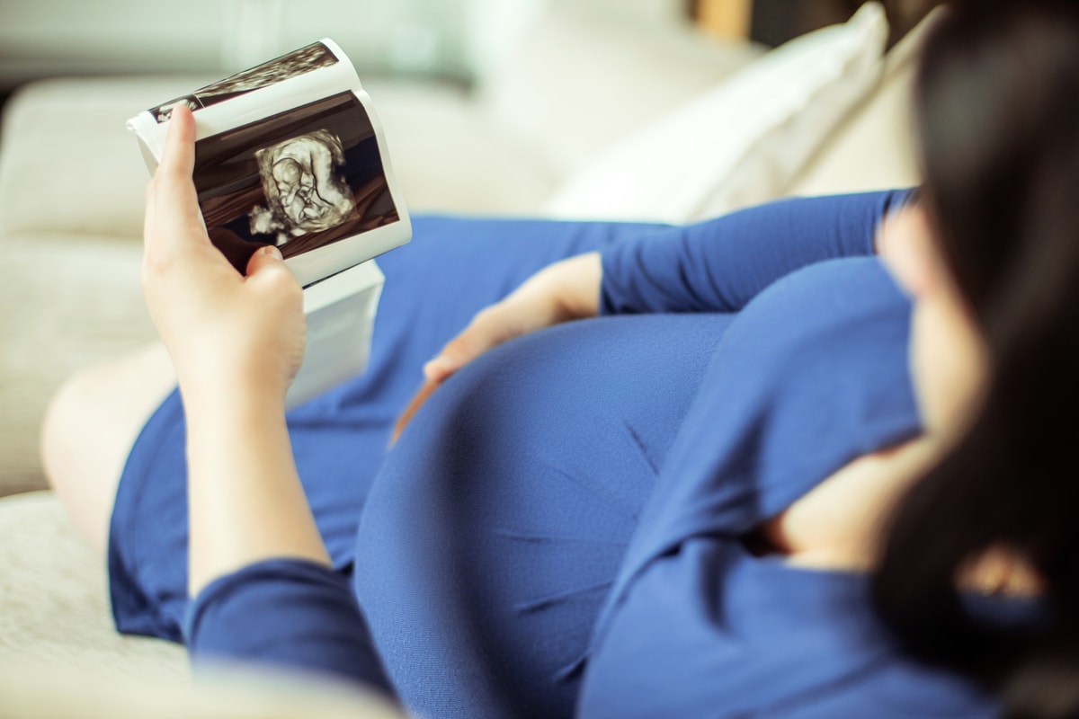 USG prenatalne
