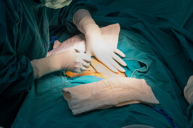 cesarean
