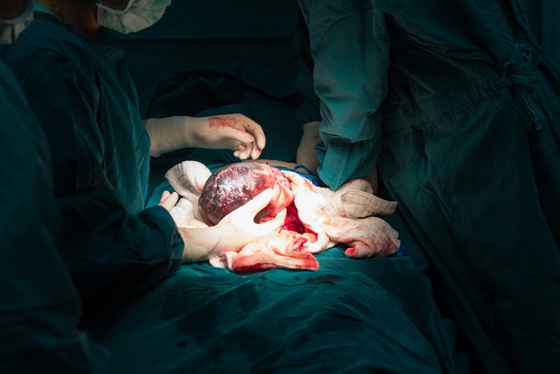 cesarean