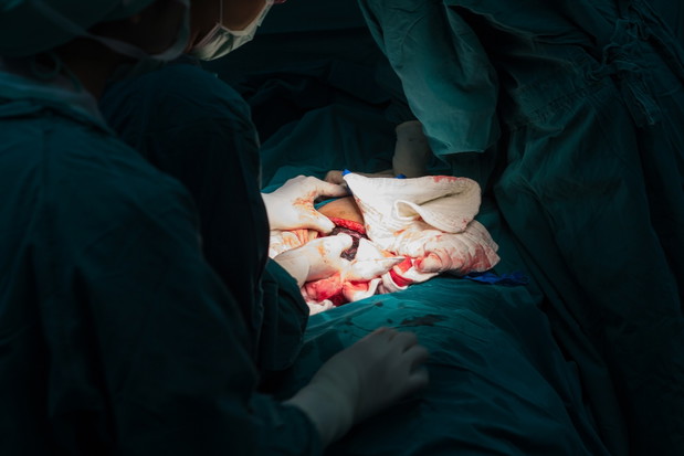 cesarean
