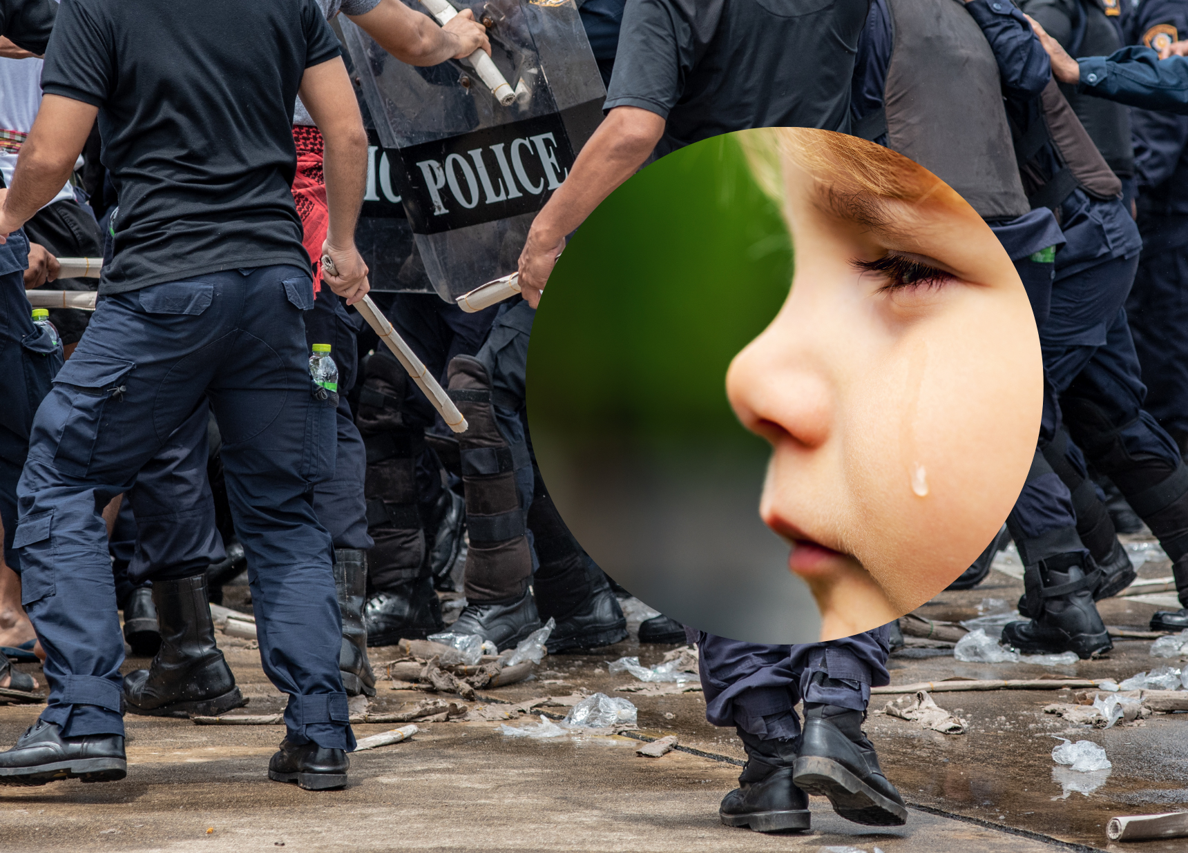 Dziecko ranne podczas demonstracji antyszczepionkowców. Policja: „To nieludzkie”