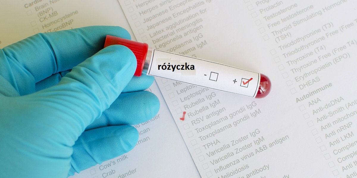 Różyczka, badanie w ciąży