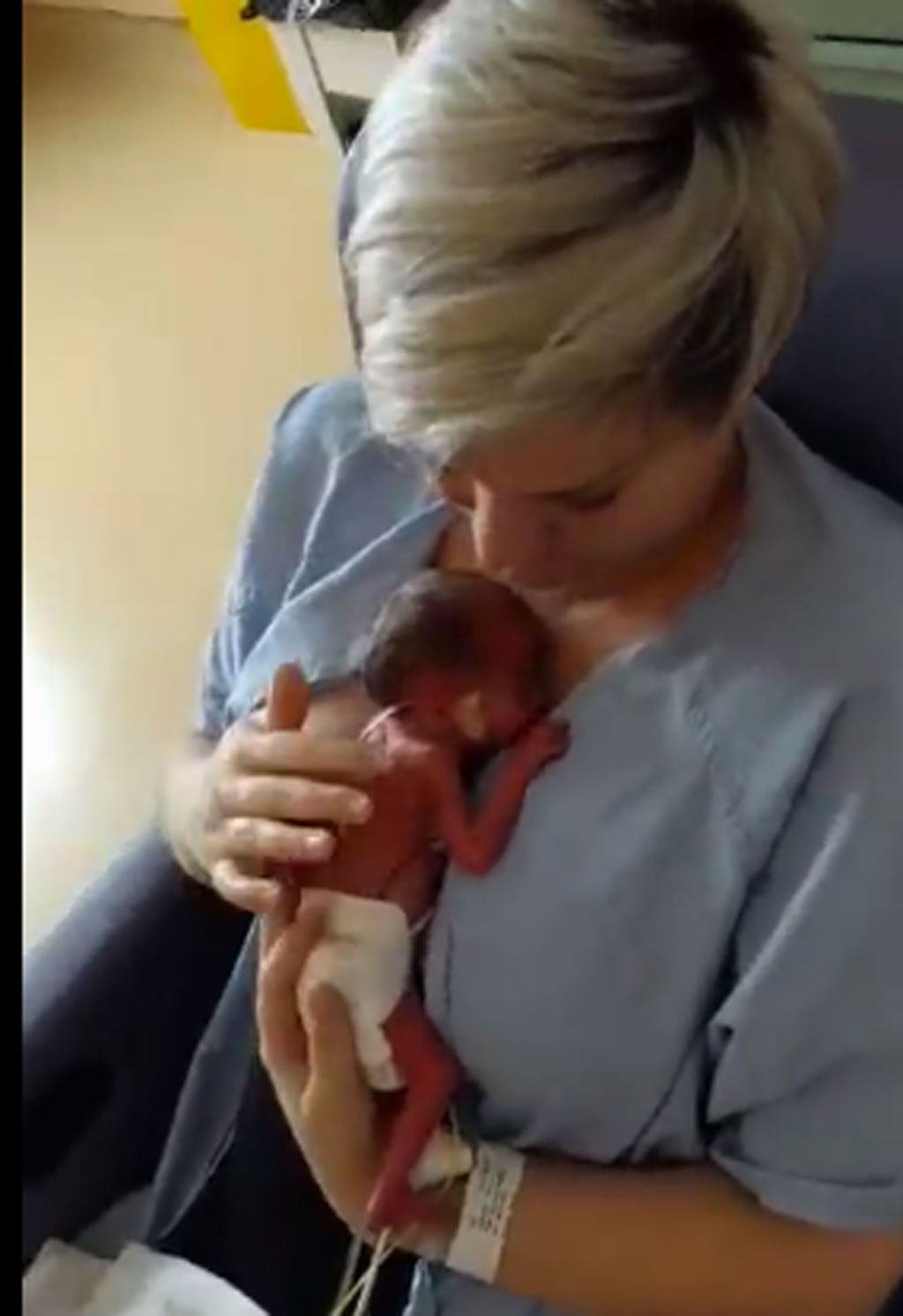 mama przytula wcześniaka wideo