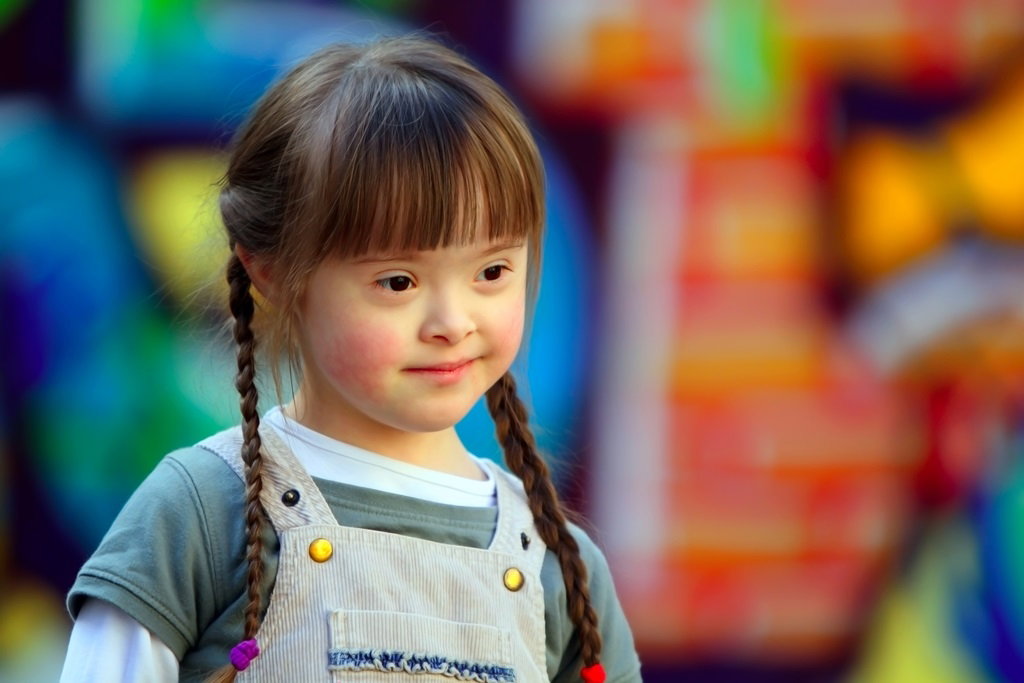 girl with Down syndrome