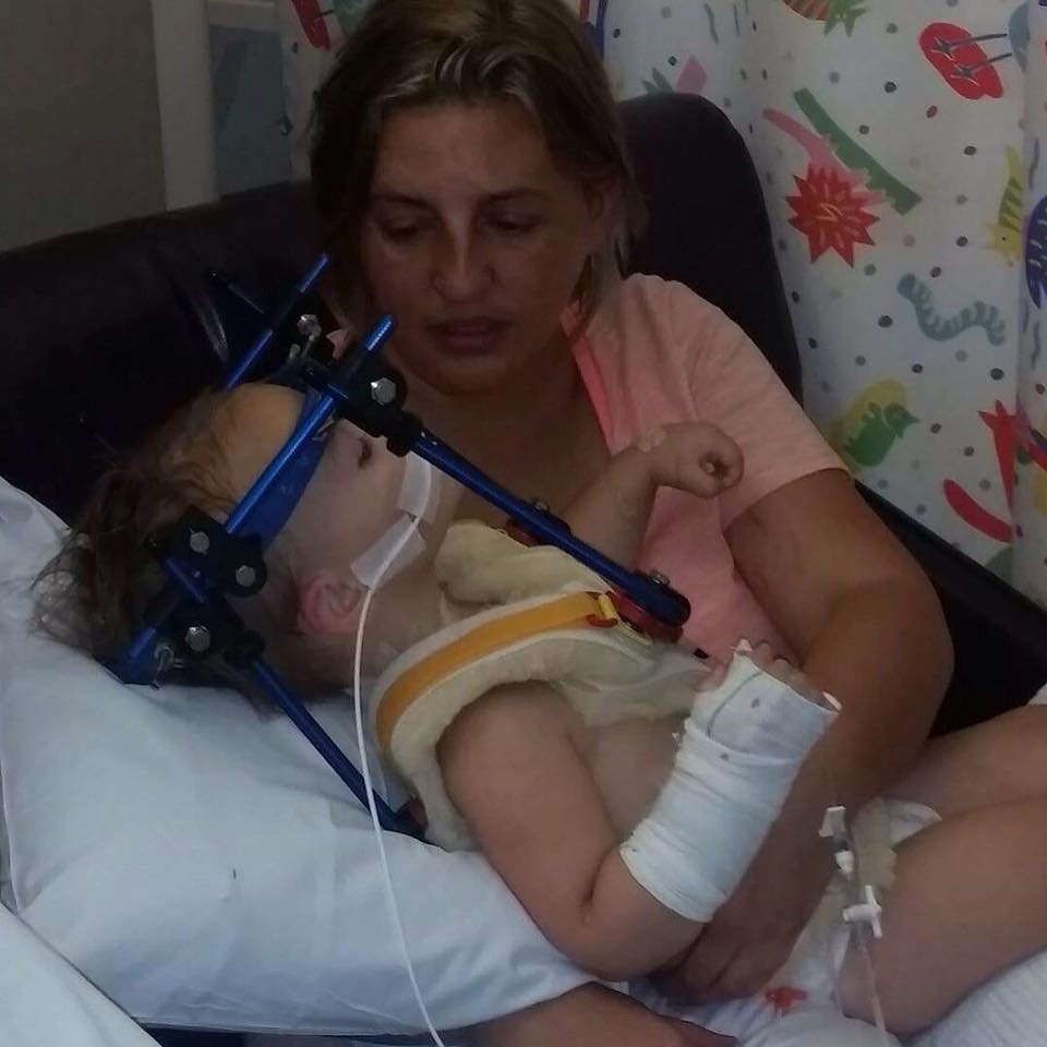 Dziewczynka doznała poważnych obrażeń, bo siedziała w foteliku przodem do kierunku jazdy