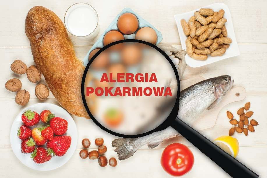alergia pokarmowa
