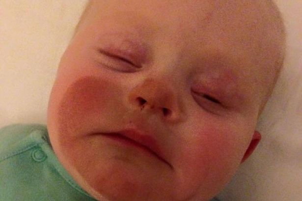 Niemowlę ubrudzone samoopalaczem, który mama stosowała podczas karmienia piersią