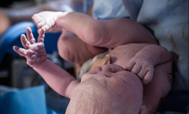 Jak wygląda główka dziecka w czasie porodu