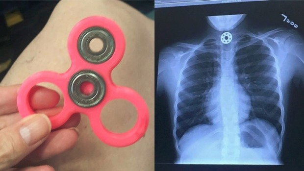 Fidget spinner – zabawka zręcznościowa dla dzieci