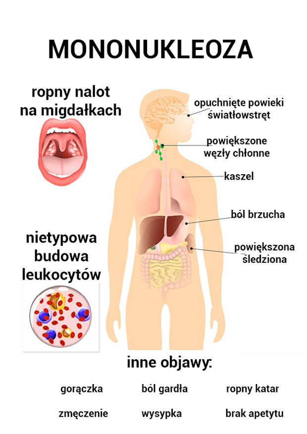 imgLhPv43-5840fee