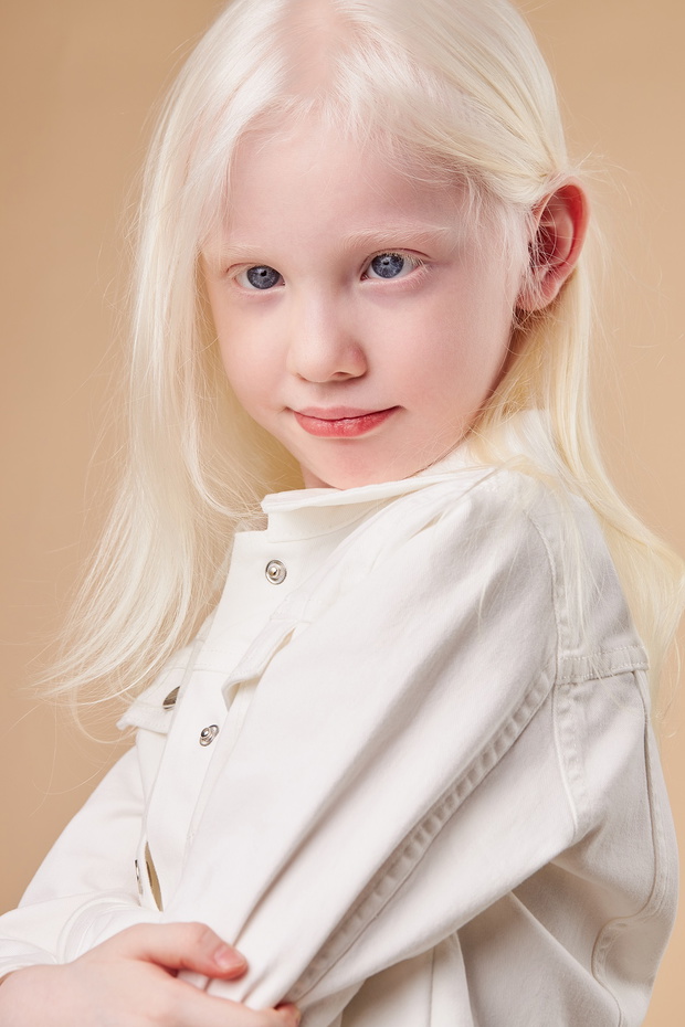portrait of smiling albino child isolated