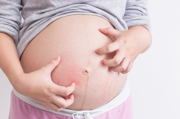Pregnant woman scratching her belly