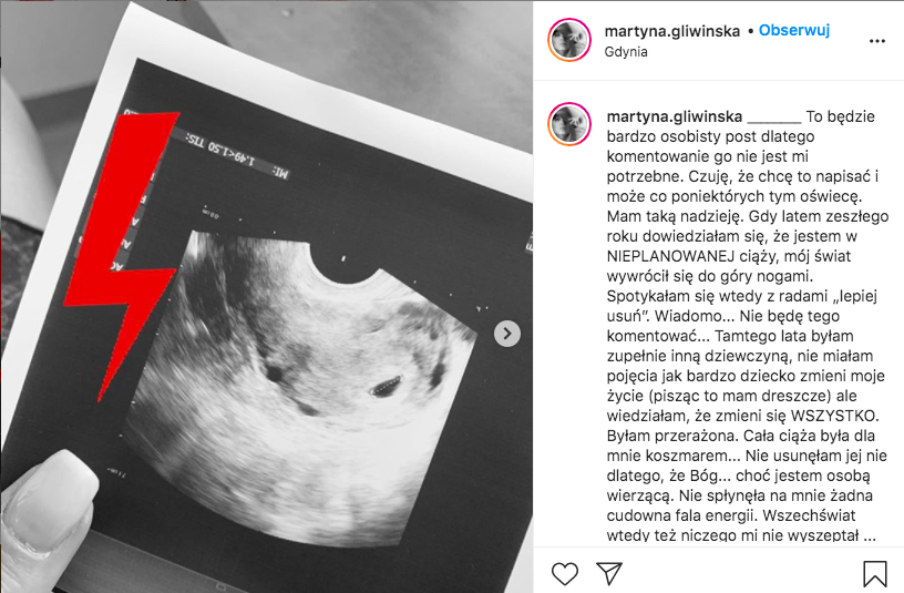 Martyna Gliwińska opowiedziała o nieplanowanej ciąży