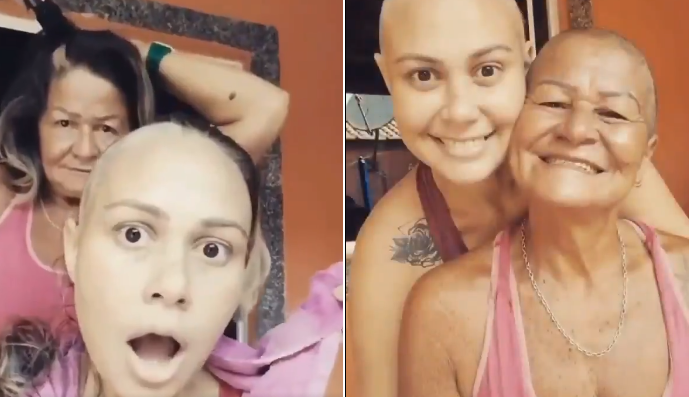 Mama ogoliła głowę z miłości do córki