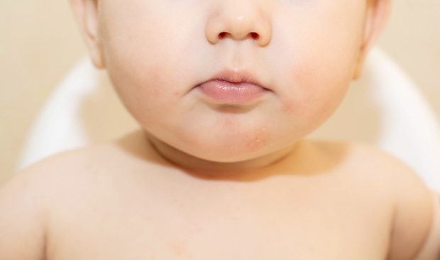 IRRITATION FROM SLEEVE AT A CHILD.