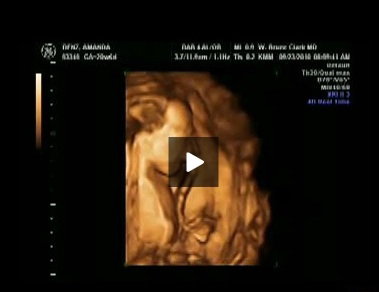 21 tydzień ciąży, usg w ciąży, film z usg w ciąży