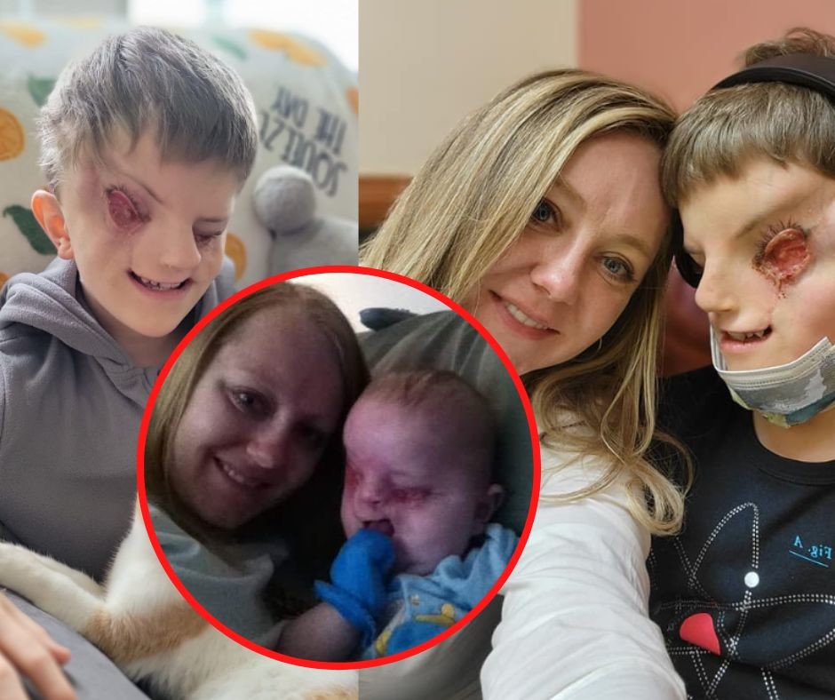 chlopiec bez oczu