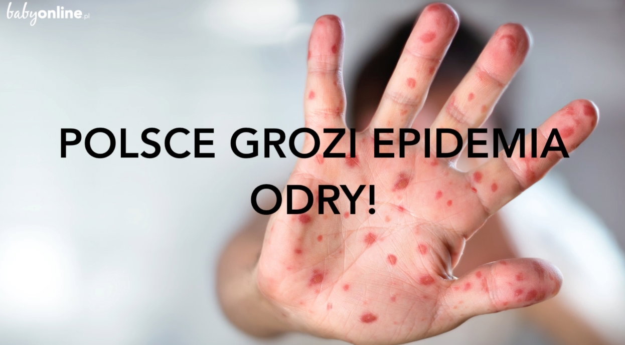 Epidemia odry