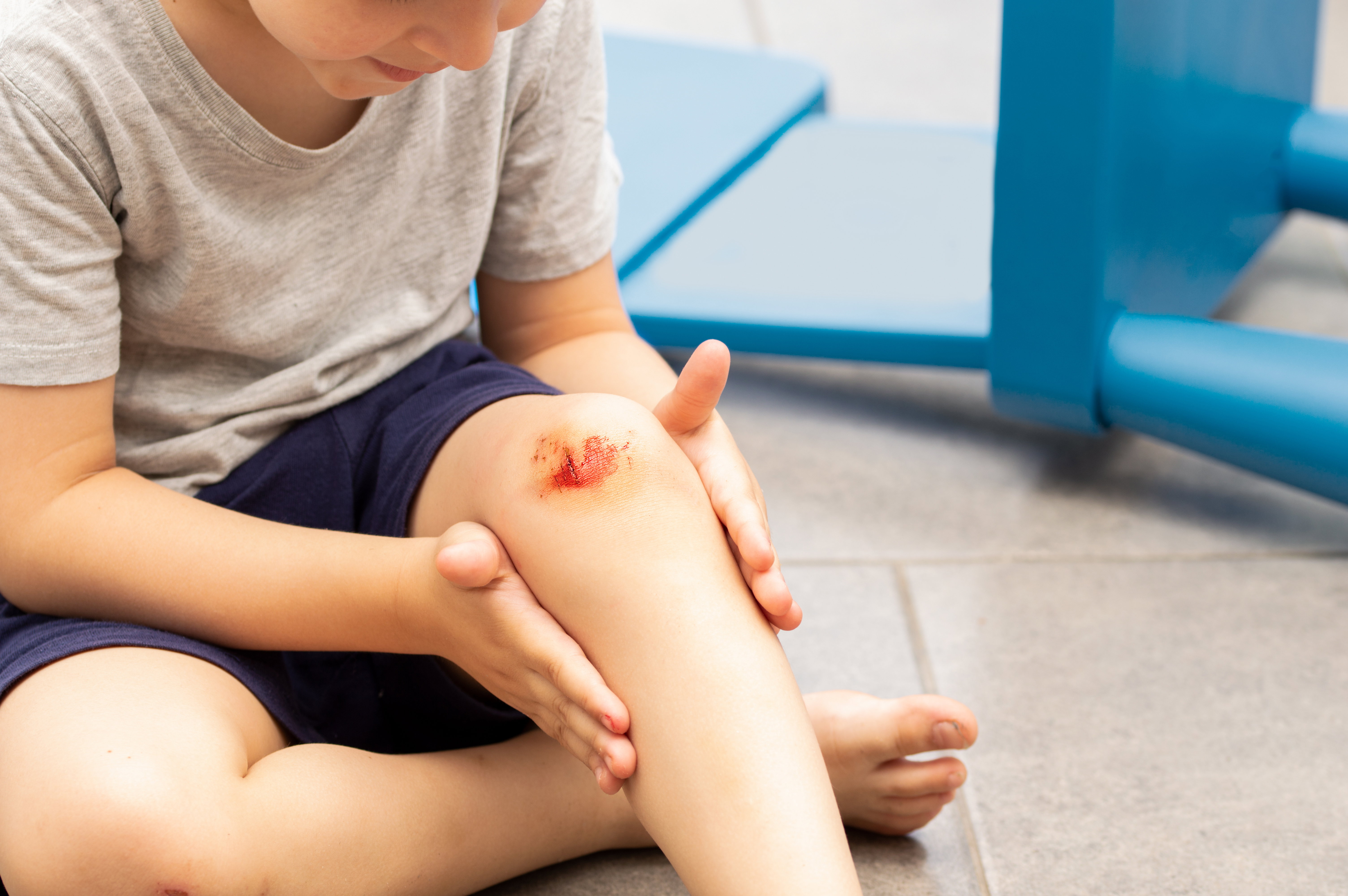 Boy with a scraped knee