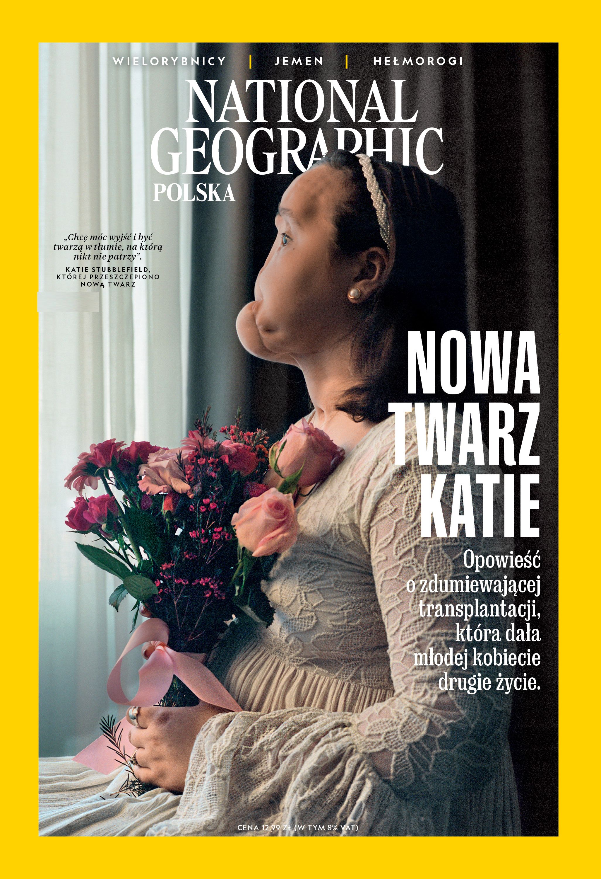 „Nowa twarz Katie”: National Geographic publikuje reportaż o najmłodszej w USA pacjentce, która otrzymała całkowity przeszczep twarzy.