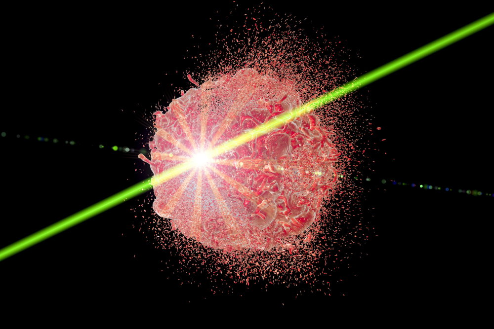 Laser