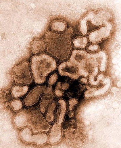 Wirus_grypy_A_H1N1_-_zdjecie_1256132078804_kopia